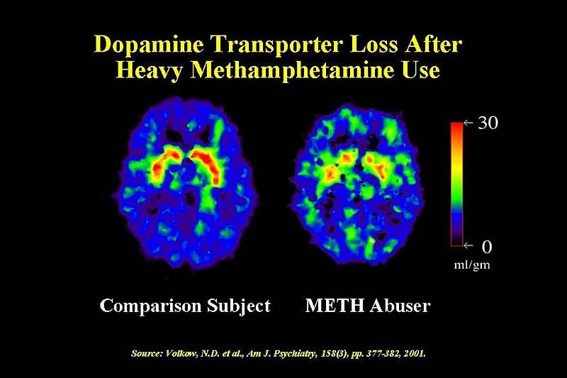 Dopamine Transporter Meth