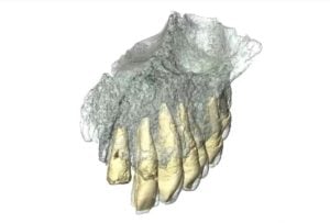 Oldest Human Fossils