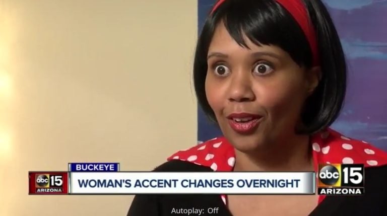 Woman Fell Asleep With A Headache And Woke Up With British Accent