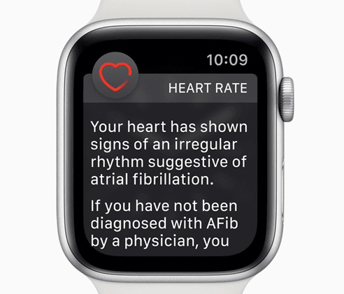 Apple Watch ECG Feature