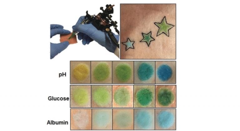 These Color-Changing Tattoos Can Help Track Glucose Levels